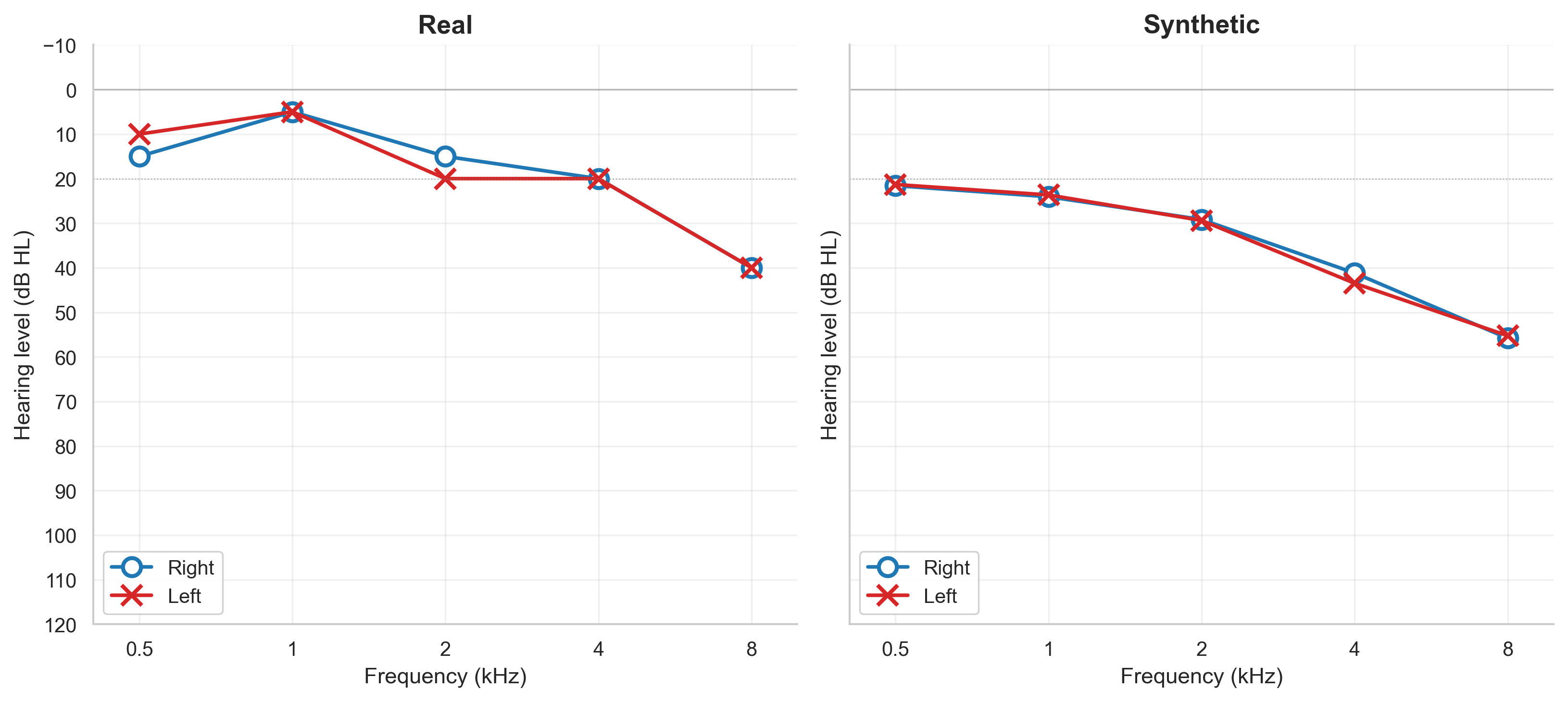 Two audiograms side by side. The left panel, labelled "Real", shows a hearing test from a real person, with thresholds dipping to about 40 dB at 8 kHz. The right panel, labelled "Synthetic", shows a hearing test produced by our AI method, with a similar gentle slope from low to high frequencies and the two ears tracking closely.